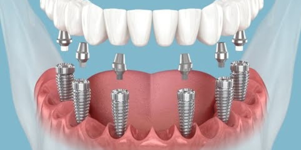 Top Dental Clinic in Pune for Comprehensive Oral Health Services