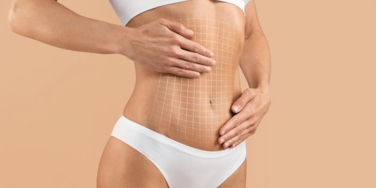 How Tummy Tuck in Islamabad Addresses Excess Abdominal Tissue
