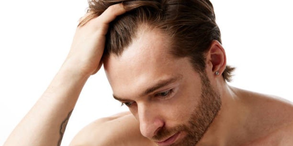 Hair Transplant For Thick Hair: Achieving Balanced Density