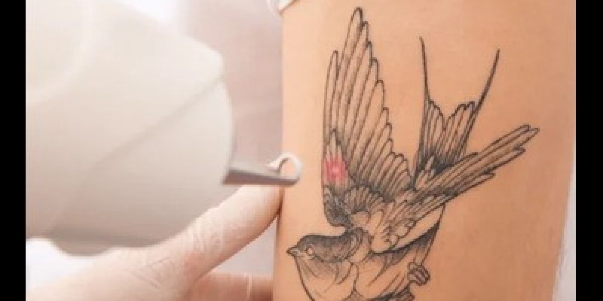 How Effective Is Laser Tattoo Removal for Professional Tattoos?