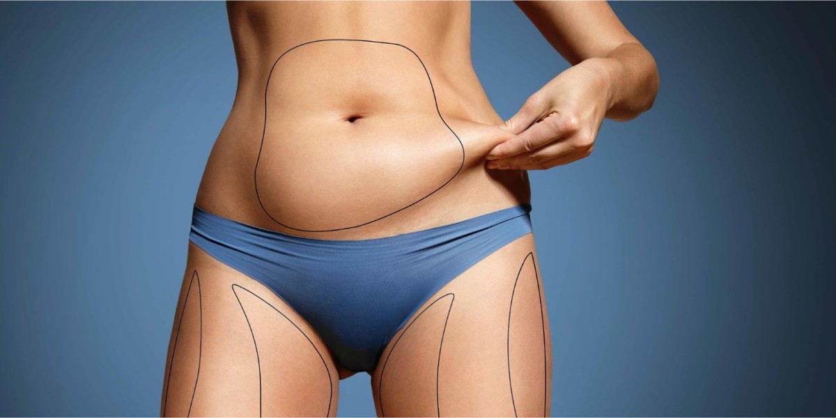 Abdominoplasty Dubai: How Is Abdominal Anatomy Assessed Before Surgery?