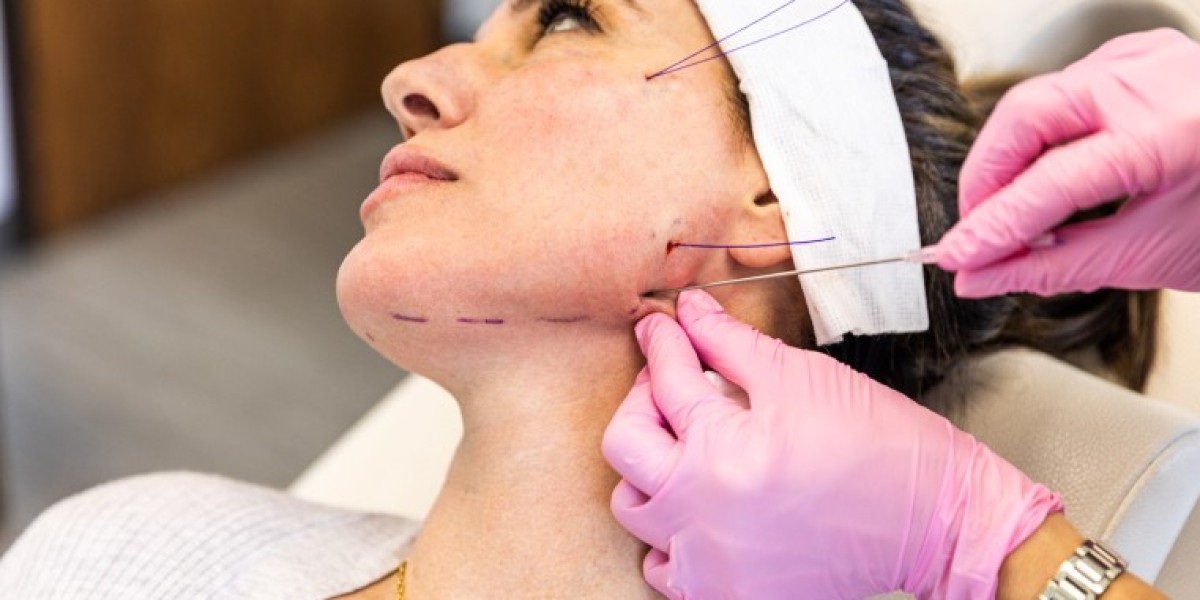 Thread Lift in London: How Is Facial Skin and Tissue Assessed Before Treatment?