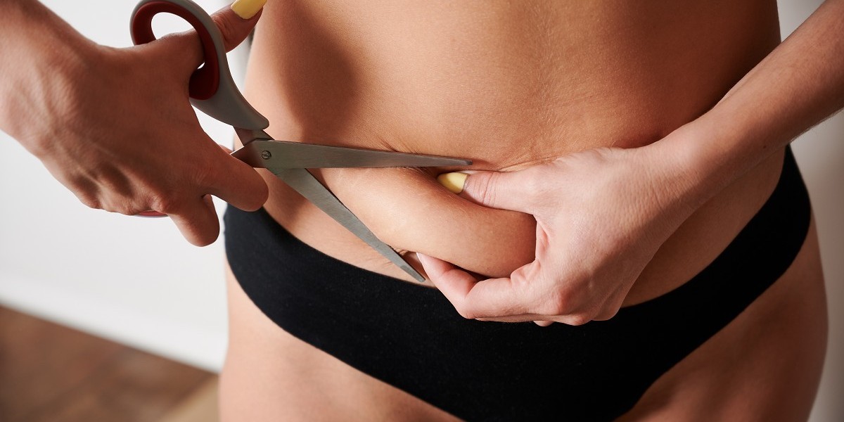 Liposuction in Islamabad: Shape Meets Precision