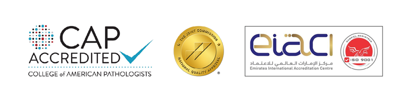 IVF-ICSI