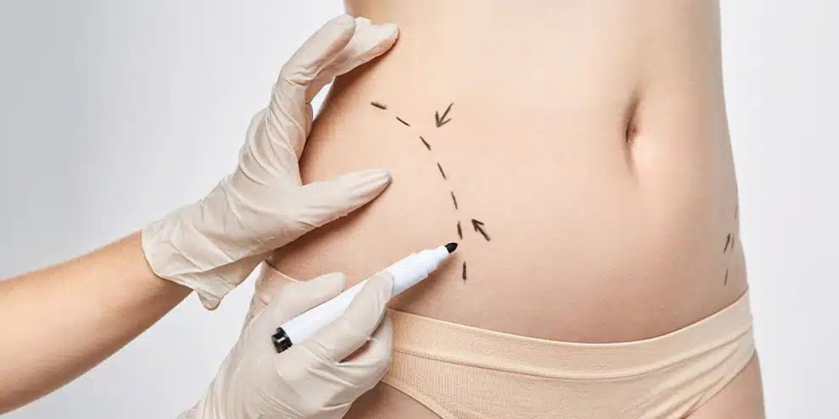 Body Contouring in Dubai: When Can You Return to Exercise?