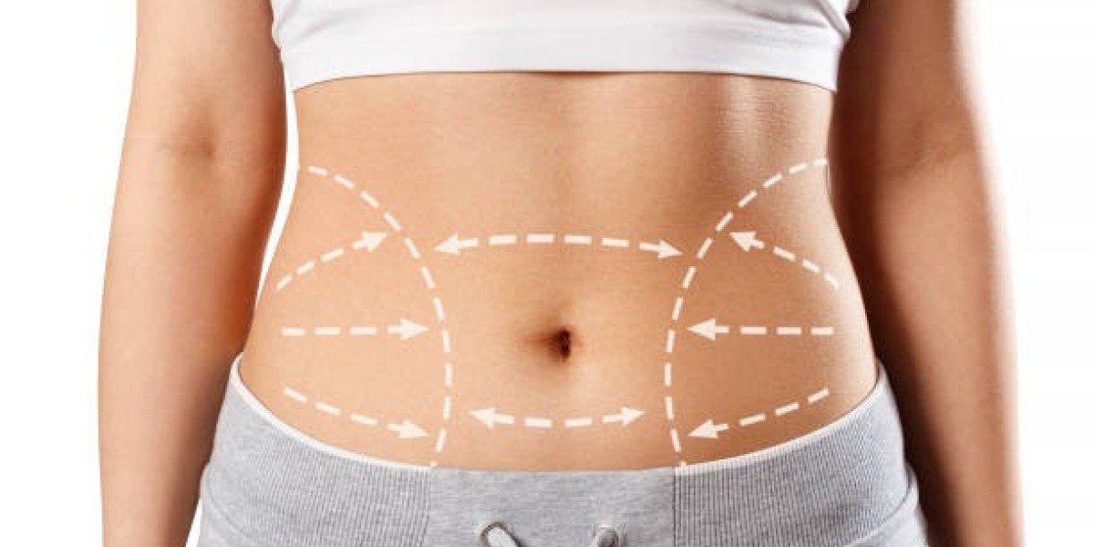 Liposuction and Mommy Makeover: Understanding the Options