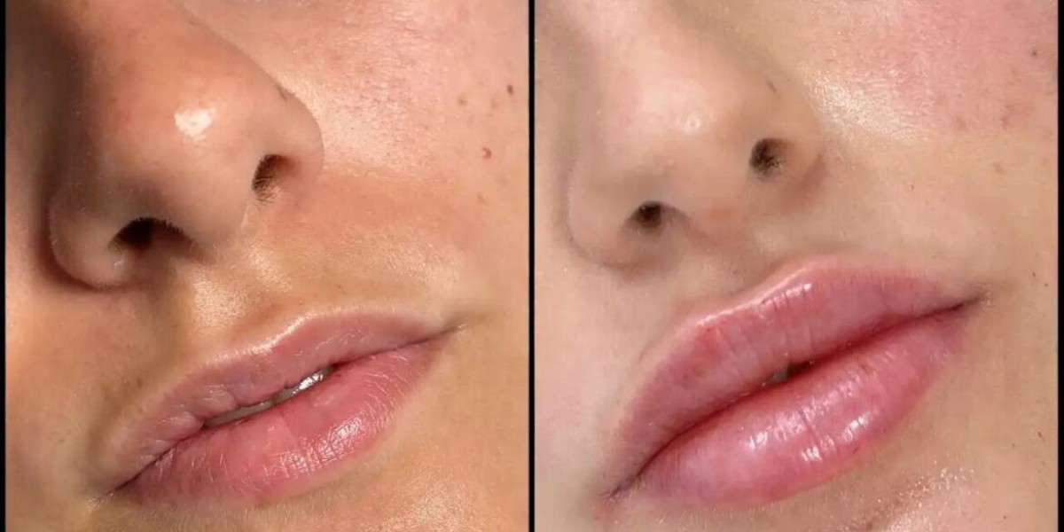 Best Plastic Surgeons in Dubai for Elegant Facial Definition