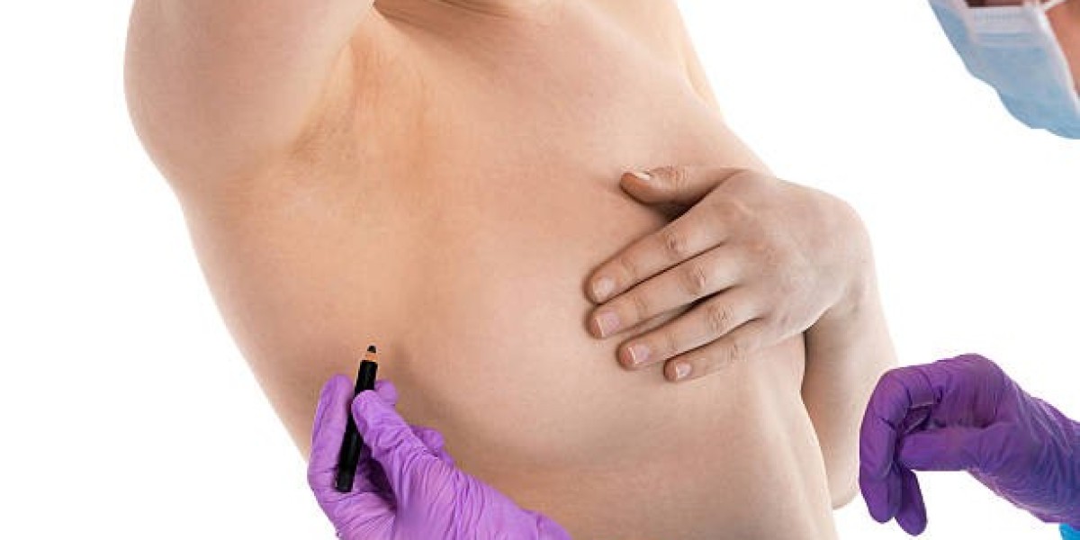 Breast Augmentation Readiness: Questions to Ask Your Surgeon